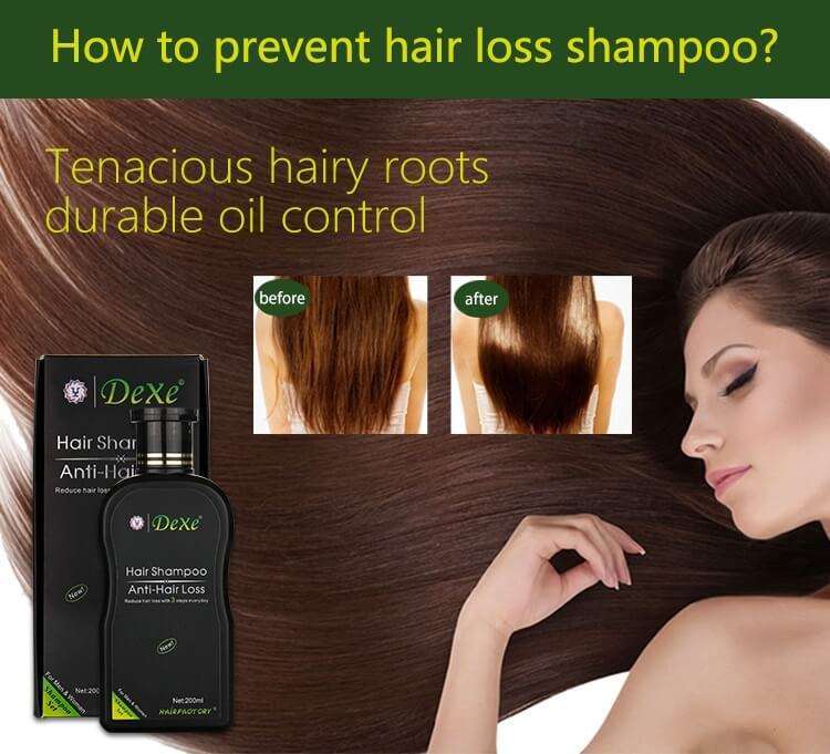 Dexe-Anti-Hair-Loss-Shampoo